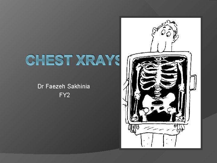  CHEST XRAYS Dr Faezeh Sakhinia FY 2 