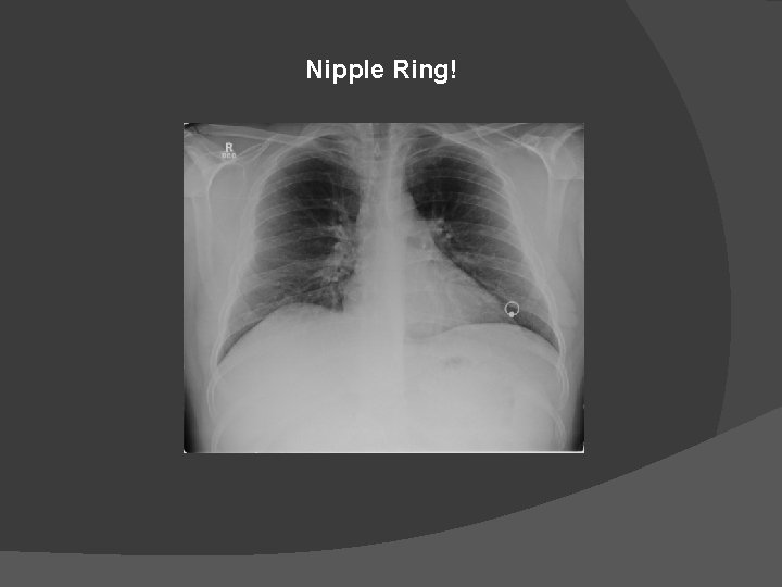 Nipple Ring! 