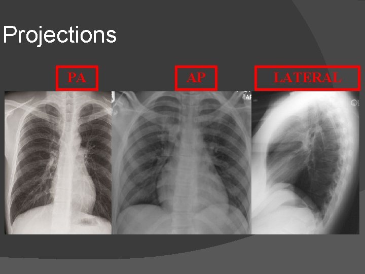 Projections PA AP LATERAL 