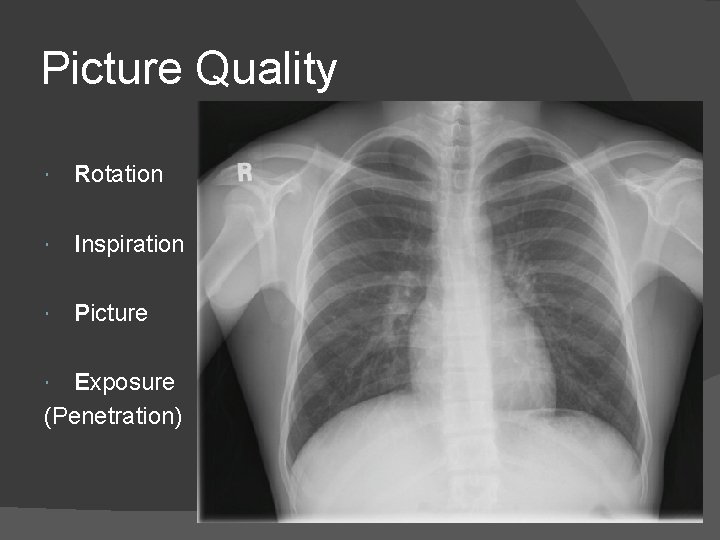 Picture Quality Rotation Inspiration Picture Exposure (Penetration) 