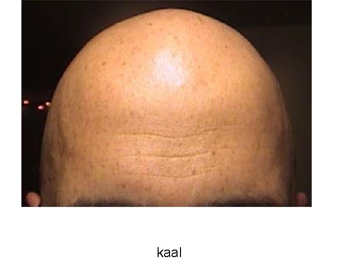 kaal 