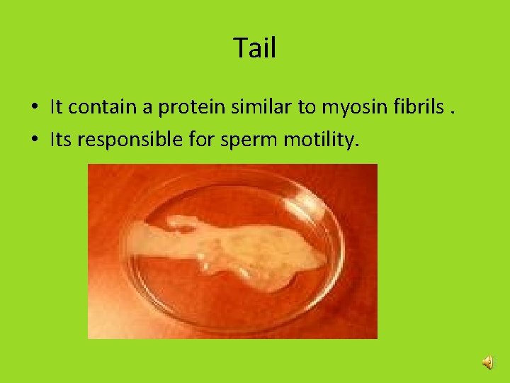 Tail • It contain a protein similar to myosin fibrils. • Its responsible for Tail • It contain a protein similar to myosin fibrils. • Its responsible for