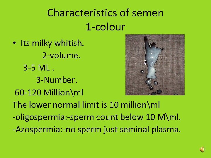 Characteristics of semen 1 -colour • Its milky whitish. 2 -volume. 3 -5 ML. Characteristics of semen 1 -colour • Its milky whitish. 2 -volume. 3 -5 ML.