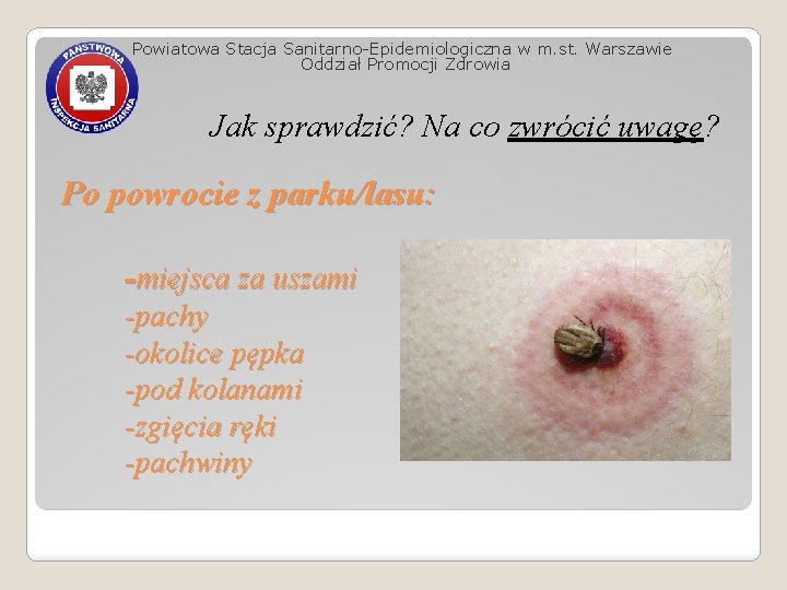 Powiatowa Stacja Sanitarno-Epidemiologiczna w m. st. Warszawie Oddział Promocji Zdrowia Jak sprawdzić? Na co