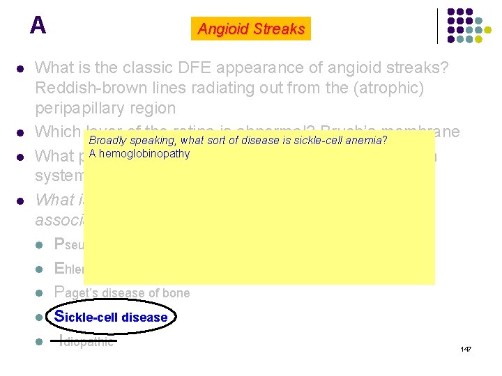 A l l Angioid Streaks What is the classic DFE appearance of angioid streaks?