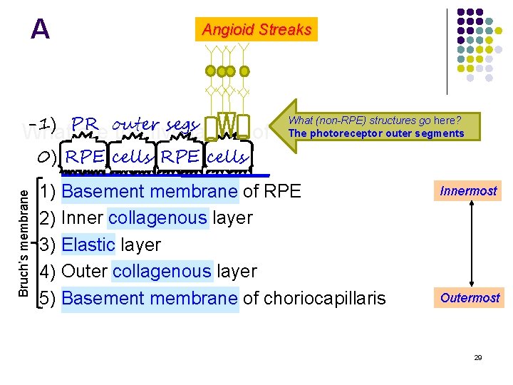 A Angioid Streaks -1) PR outer segs What (non-RPE) structures go here? The photoreceptor