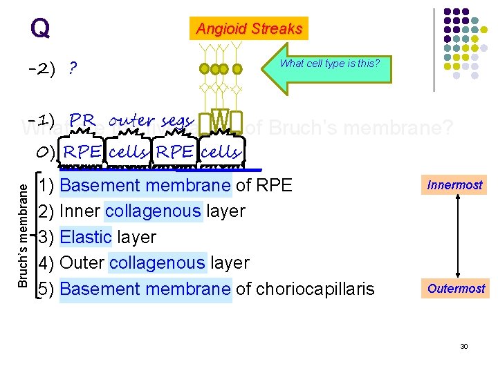 Q Angioid Streaks -2) ? What cell type is this? Bipolar cells -1) PR