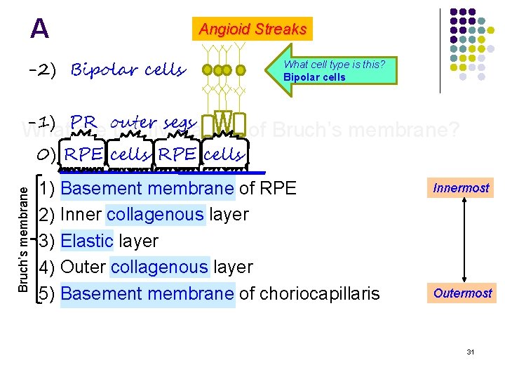 A Angioid Streaks -2) Bipolar cells What cell type is this? Bipolar cells -1)