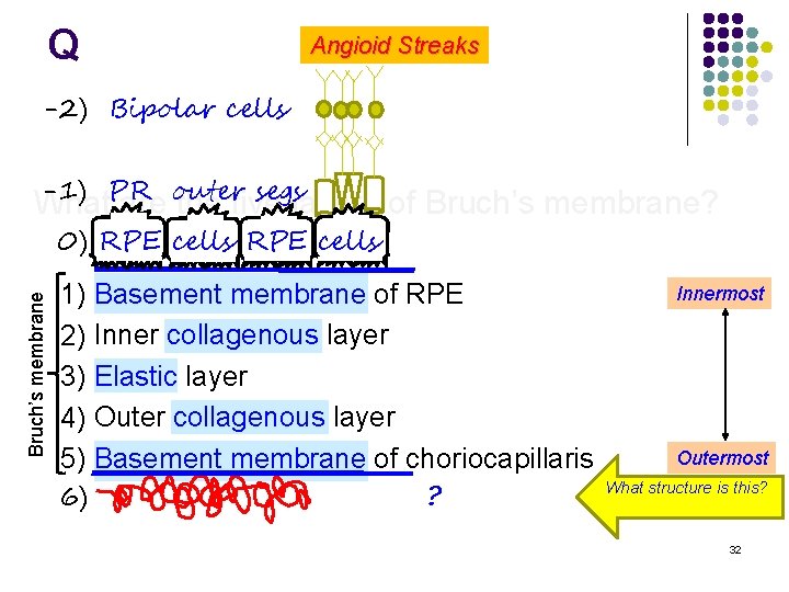 Q Angioid Streaks -2) Bipolar cells -1) PR outer segs What are the five