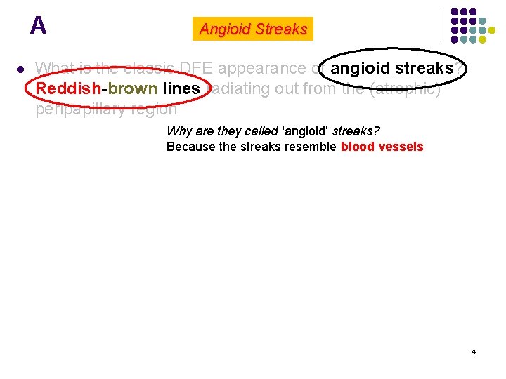 A l Angioid Streaks What is the classic DFE appearance of angioid streaks? Reddish-brown