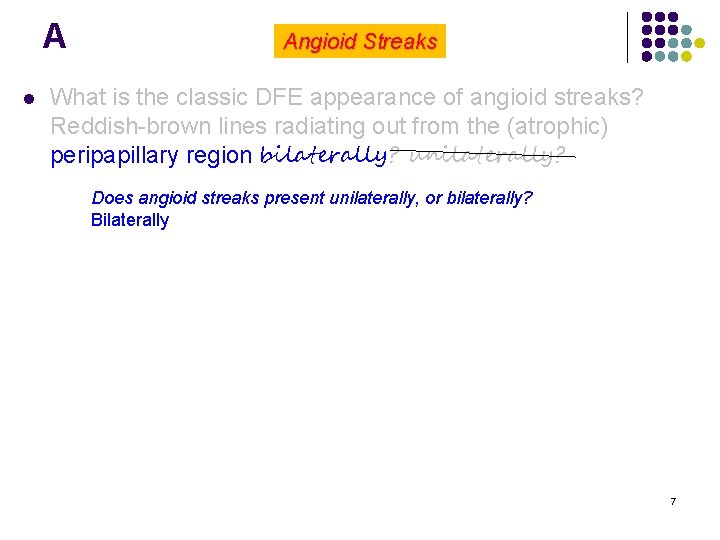 A l Angioid Streaks What is the classic DFE appearance of angioid streaks? Reddish-brown