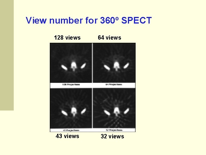 View number for 360º SPECT 128 views 43 views 64 views 32 views View number for 360º SPECT 128 views 43 views 64 views 32 views