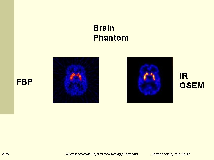 Brain Phantom IR OSEM FBP 2015 Nuclear Medicine Physics for Radiology Residents Sameer Tipnis, Brain Phantom IR OSEM FBP 2015 Nuclear Medicine Physics for Radiology Residents Sameer Tipnis,