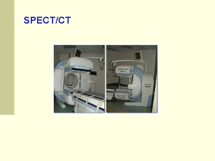 SPECT/CT SPECT/CT