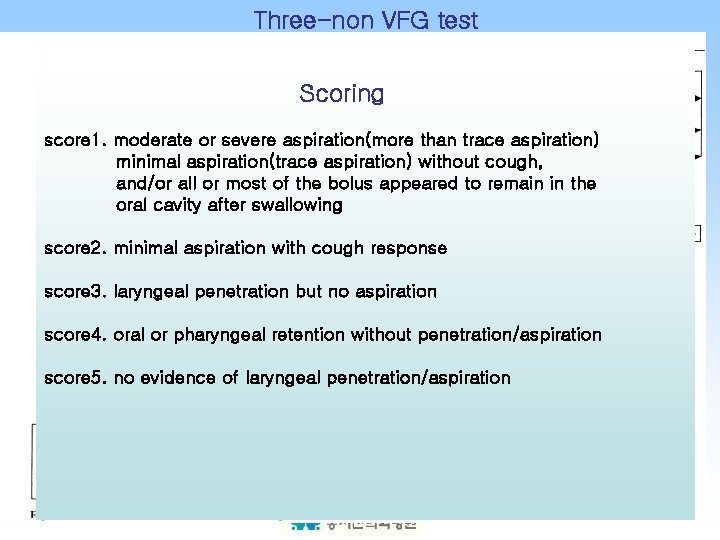 Three-non VFG test Scoring score 1. moderate or severe aspiration(more than trace aspiration) minimal