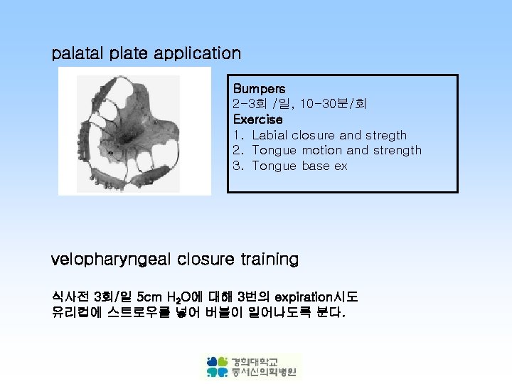 palatal plate application Bumpers 2 -3회 /일, 10 -30분/회 Exercise 1. Labial closure and