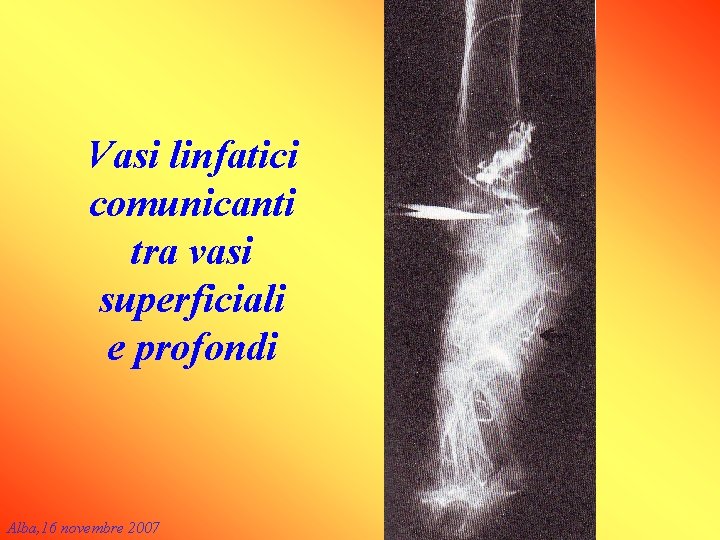 Vasi linfatici comunicanti tra vasi superficiali e profondi Alba, 16 novembre 2007 