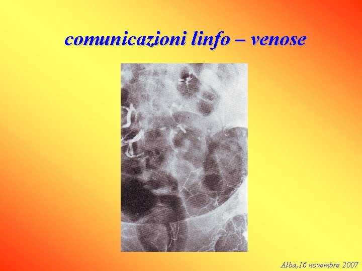 comunicazioni linfo – venose Alba, 16 novembre 2007 