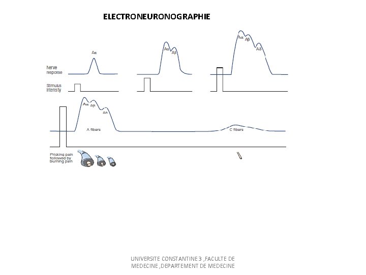ELECTRONEURONOGRAPHIE UNIVERSITE CONSTANTINE 3 , FACULTE DE MEDECINE , DEPARTEMENT DE MEDECINE 