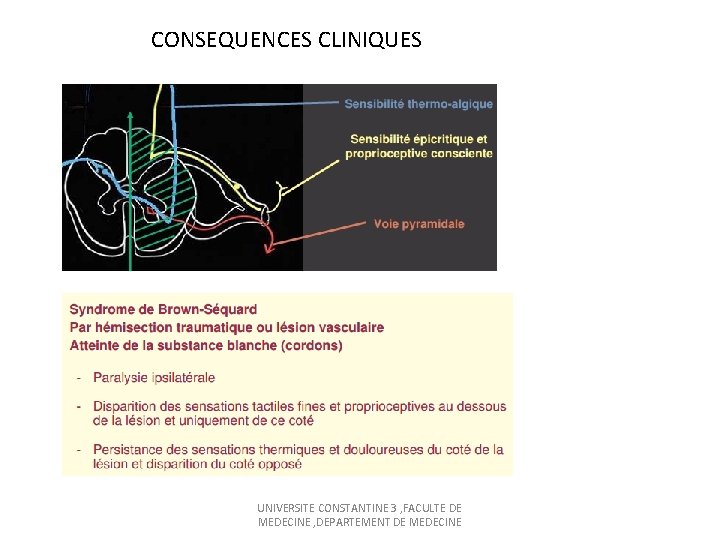 CONSEQUENCES CLINIQUES UNIVERSITE CONSTANTINE 3 , FACULTE DE MEDECINE , DEPARTEMENT DE MEDECINE 
