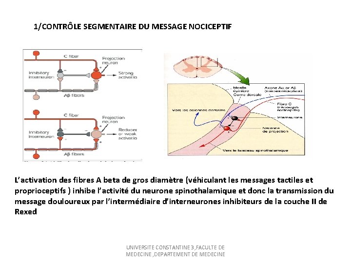 1/CONTRÔLE SEGMENTAIRE DU MESSAGE NOCICEPTIF L’activation des fibres A beta de gros diamètre (véhiculant