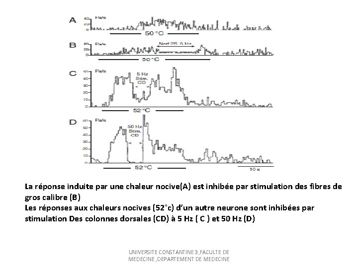 La réponse induite par une chaleur nocive(A) est inhibée par stimulation des fibres de