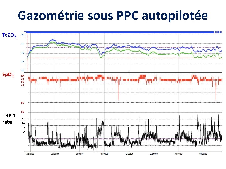 Gazométrie sous PPC autopilotée Tc. CO 2 50 45 40 35 Sp. O 2