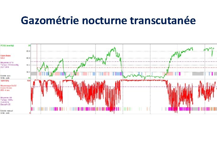 Gazométrie nocturne transcutanée 