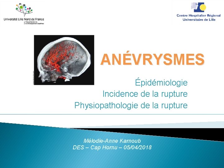 ANÉVRYSMES Épidémiologie Incidence de la rupture Physiopathologie de la rupture Mélodie-Anne Karnoub DES –