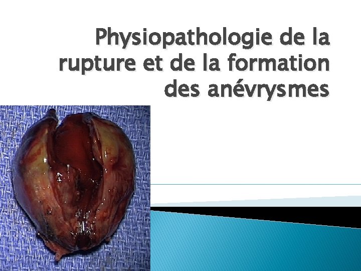 Physiopathologie de la rupture et de la formation des anévrysmes 