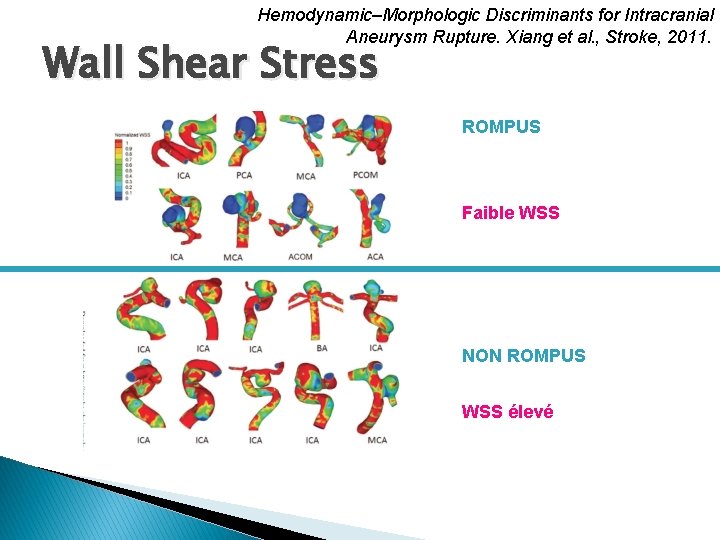 Hemodynamic–Morphologic Discriminants for Intracranial Aneurysm Rupture. Xiang et al. , Stroke, 2011. Wall Shear
