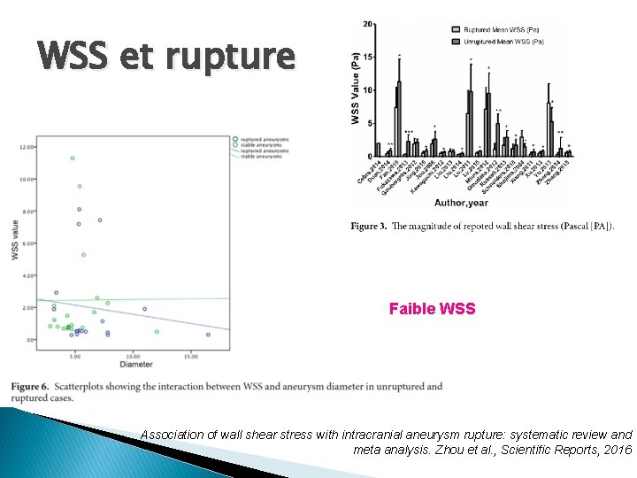 WSS et rupture Faible WSS Association of wall shear stress with intracranial aneurysm rupture: