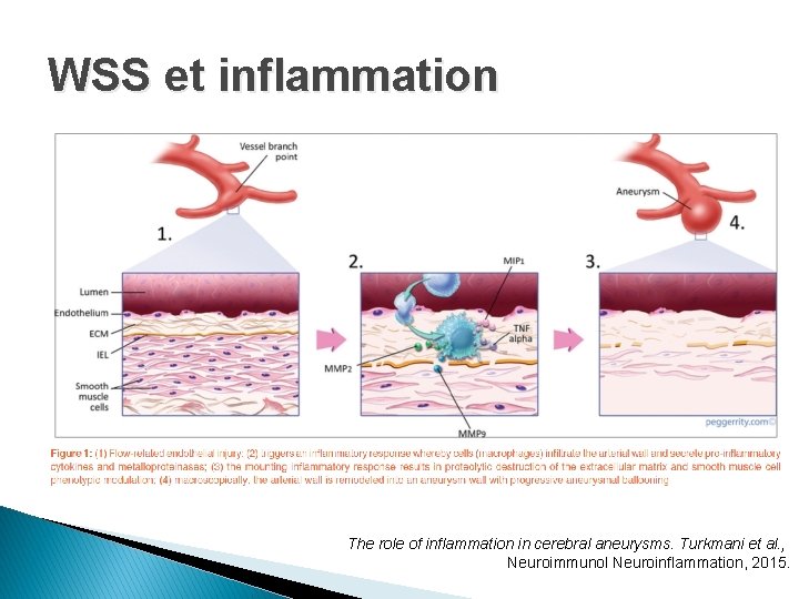 WSS et inflammation The role of inflammation in cerebral aneurysms. Turkmani et al. ,