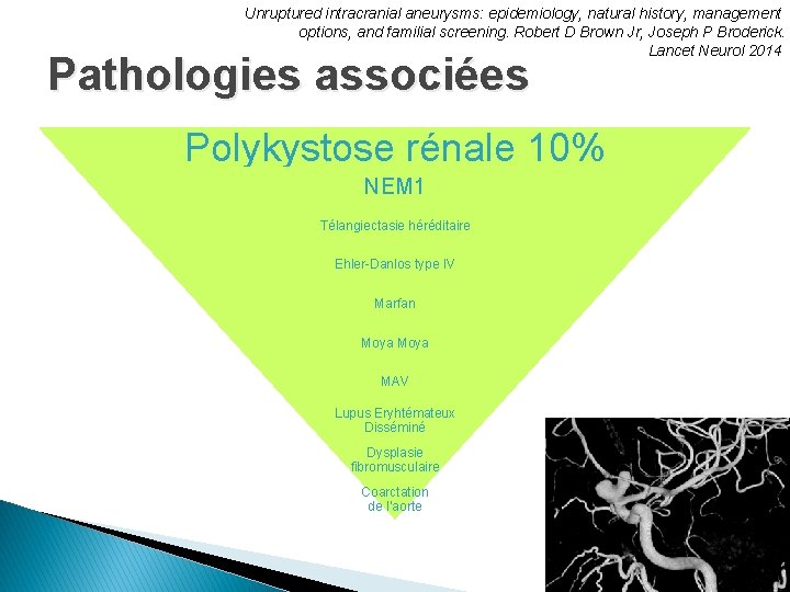 Unruptured intracranial aneurysms: epidemiology, natural history, management options, and familial screening. Robert D Brown