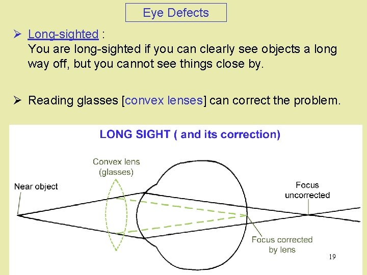 Eye Defects Ø Long-sighted : You are long-sighted if you can clearly see objects