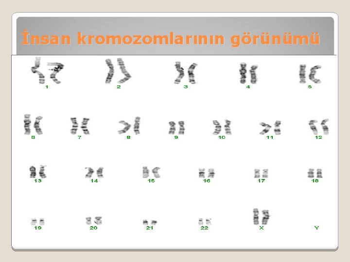 İnsan kromozomlarının görünümü 