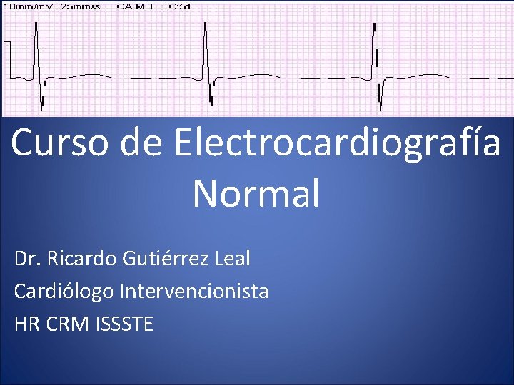 Curso de Electrocardiografía Normal Dr. Ricardo Gutiérrez Leal Cardiólogo Intervencionista HR CRM ISSSTE 