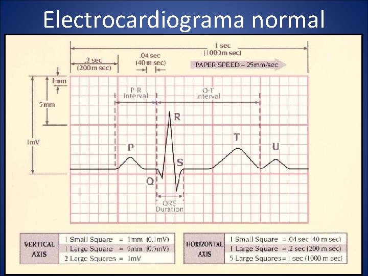 Electrocardiograma normal 