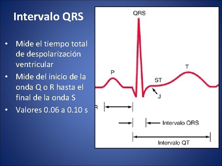 Intervalo QRS • Mide el tiempo total de despolarización ventricular • Mide del inicio
