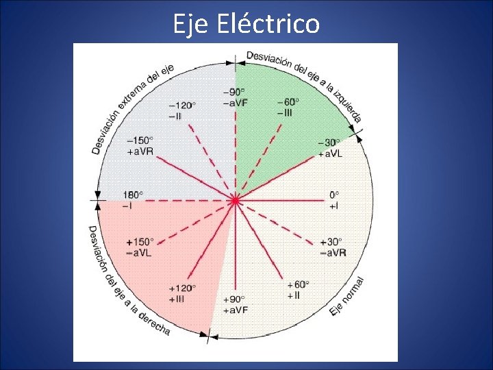 Eje Eléctrico 