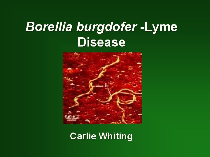 Borellia burgdofer -Lyme Disease Carlie Whiting 