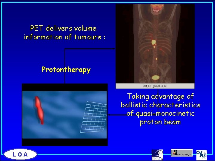 PET delivers volume information of tumours : Protontherapy Taking advantage of ballistic characteristics of