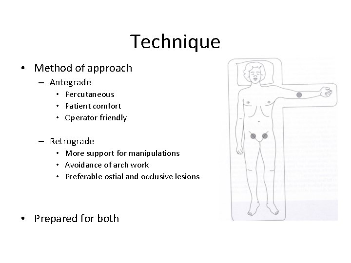 Technique • Method of approach – Antegrade • Percutaneous • Patient comfort • Operator Technique • Method of approach – Antegrade • Percutaneous • Patient comfort • Operator