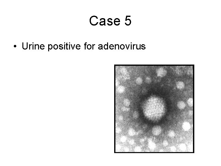 Case 5 • Urine positive for adenovirus 