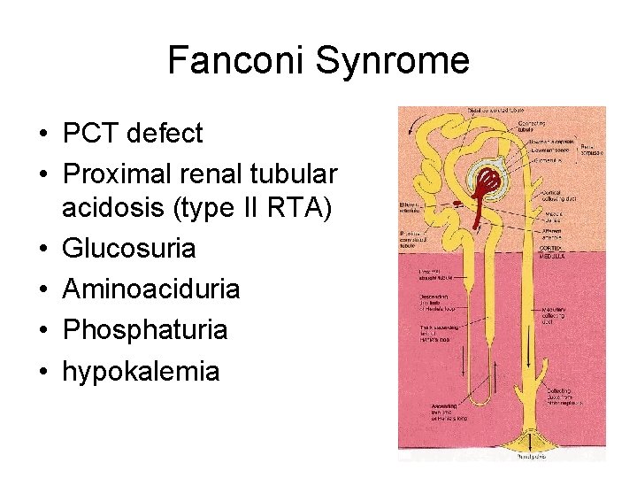 Fanconi Synrome • PCT defect • Proximal renal tubular acidosis (type II RTA) •