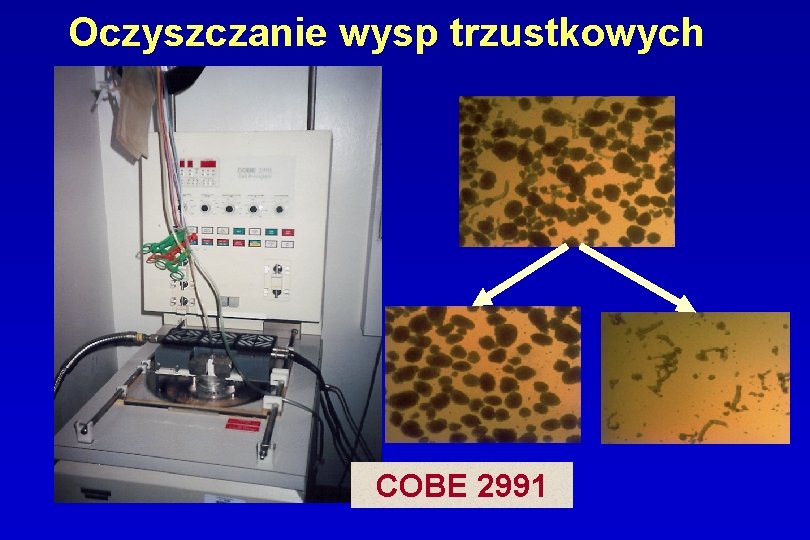 Oczyszczanie wysp trzustkowych COBE 2991 