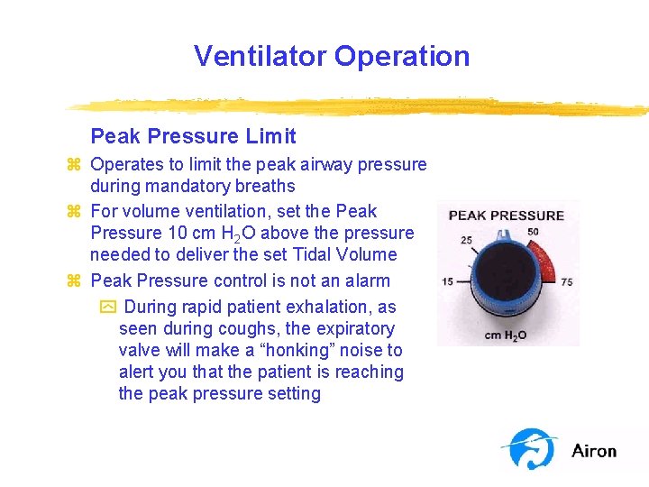 Ventilator Operation Peak Pressure Limit z Operates to limit the peak airway pressure during