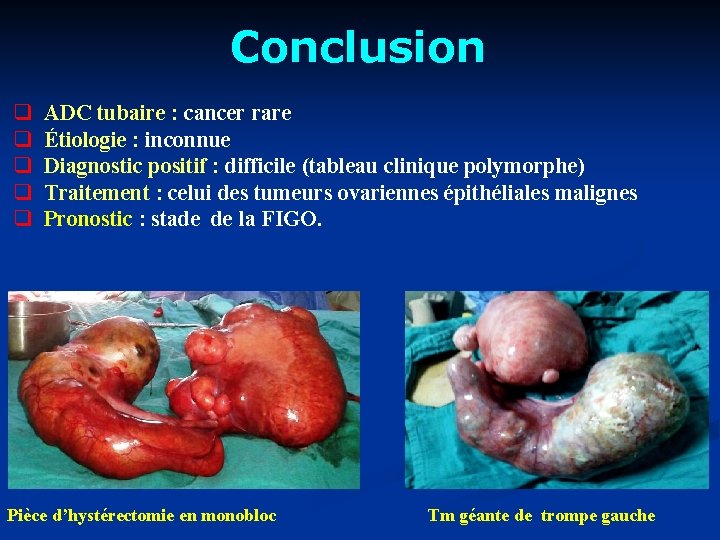 Conclusion q q q ADC tubaire : cancer rare Étiologie : inconnue Diagnostic positif