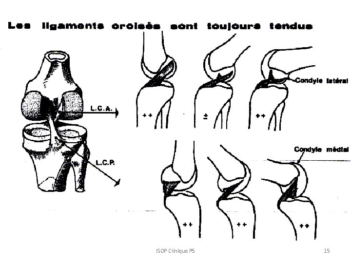 ISOP Clinique P 5 15 