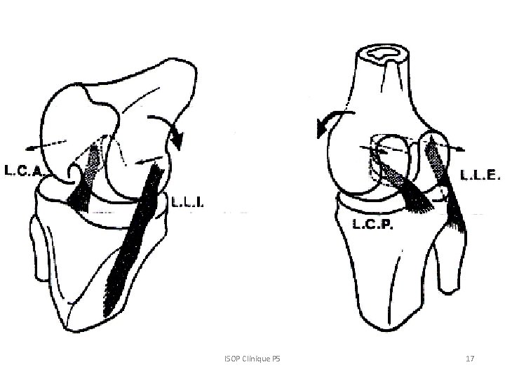 ISOP Clinique P 5 17 